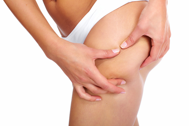 how-to-remove-cellulite